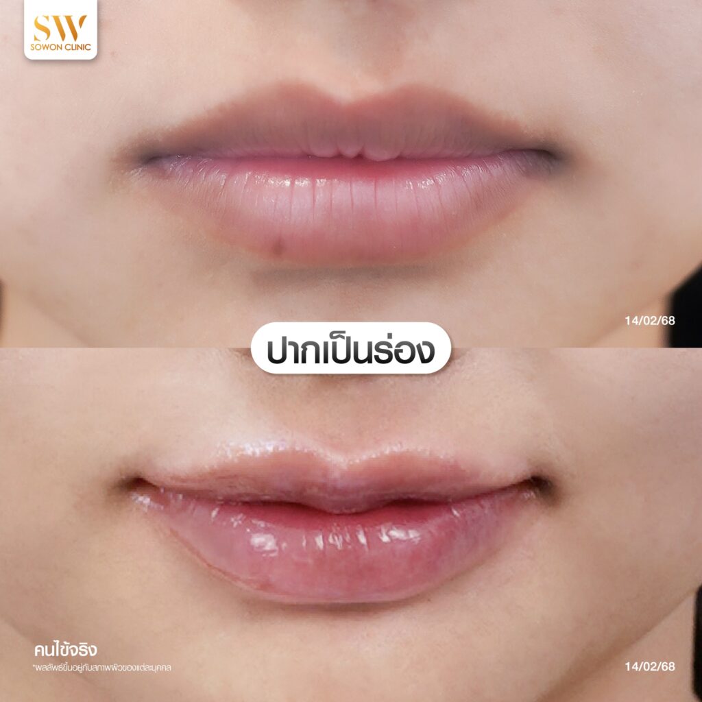 Harmony Of Lips ปากเป็นร่อง