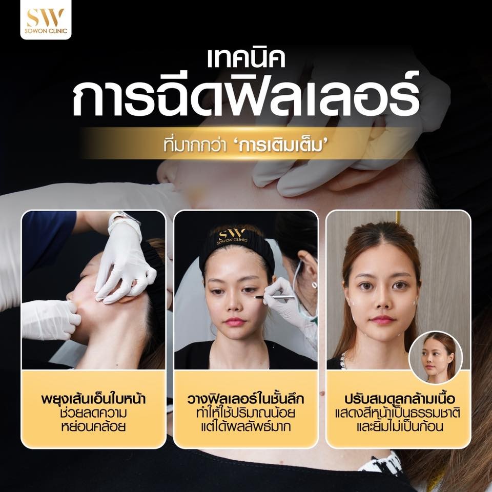 หน้าเด็ก เทคนิคฟิลเลอร์ sowon Clinic