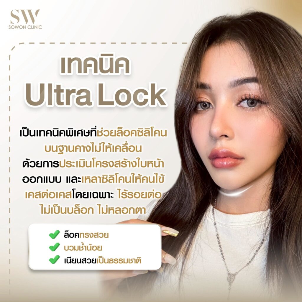 รีวิวเสริมคาง Ultra Lock