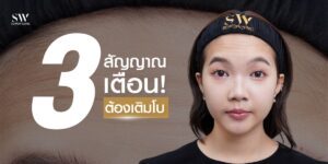 เช็คลิสต์ด่วน ! ถึงเวลาฉีดโบแล้วหรือยัง ?