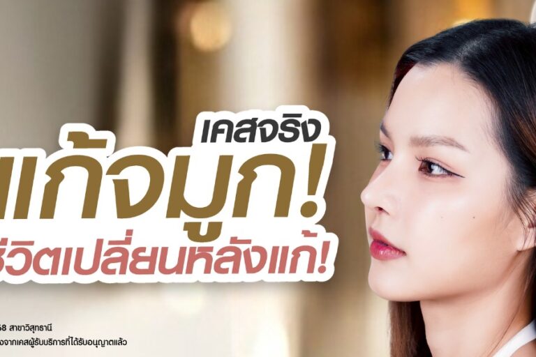 life-changing-sowon-nose-revision-surgery-nose-knowledge