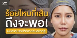 thread-lift-how-many-threads-for-results-skin-thread-knowledge