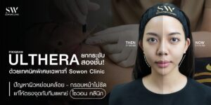 ulthera-double-technique-lift-sowon-clinic_skin-ulthera-knowledge