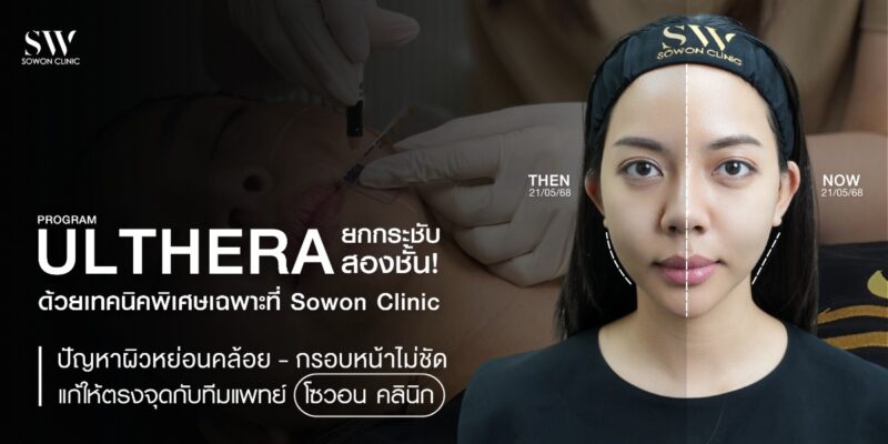 ulthera-double-technique-lift-sowon-clinic_skin-ulthera-knowledge