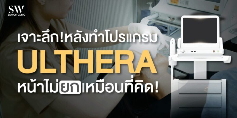 ulthera-why-not-lift-skin-ulthera-knowledge