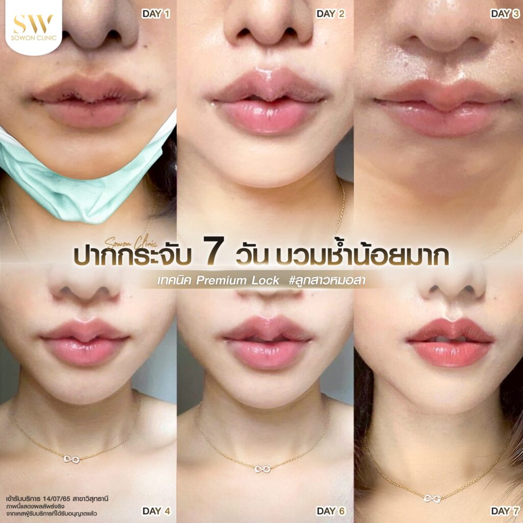 ปากกระจับ 01