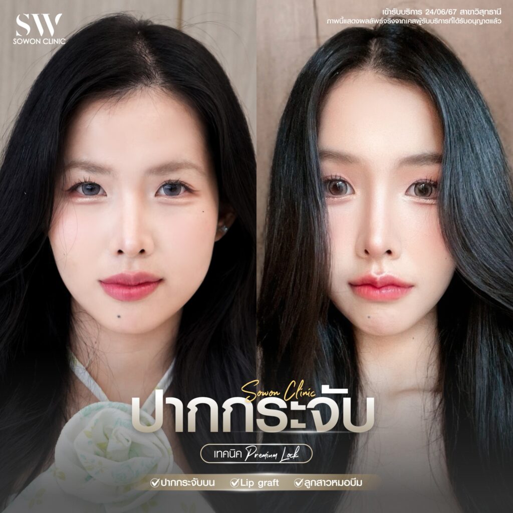 ปากกระจับ 03