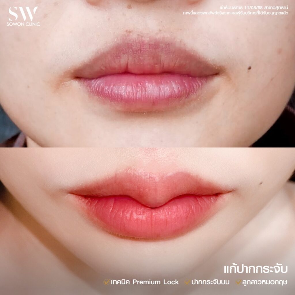 ปากกระจับ 06