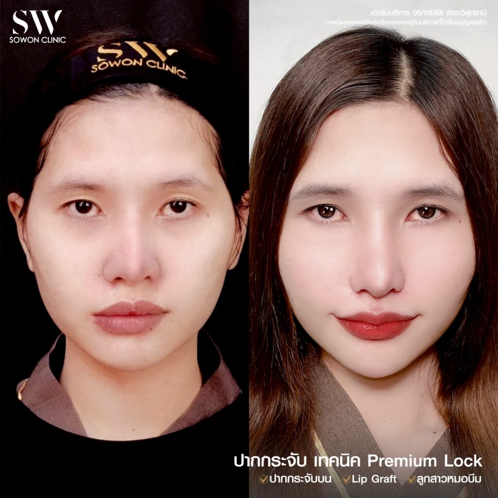 รีวิวปากกระจับ 01