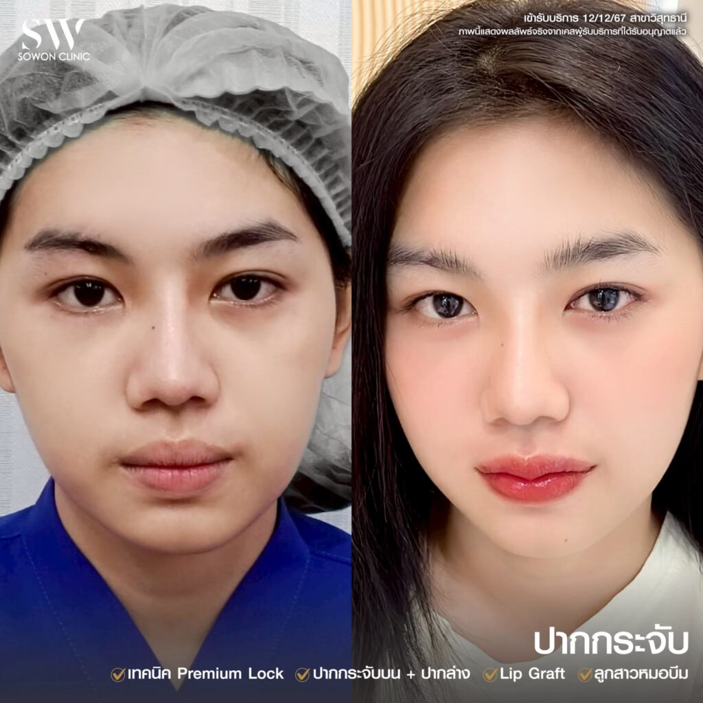 รีวิวปากกระจับ 02