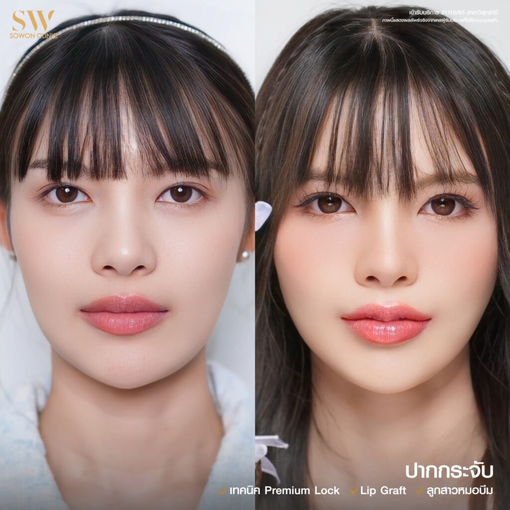 รีวิวปากกระจับ 05