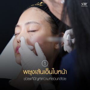 หมอปลอม เทคนิคที่ 1 การพยุงเส้นเอ็น