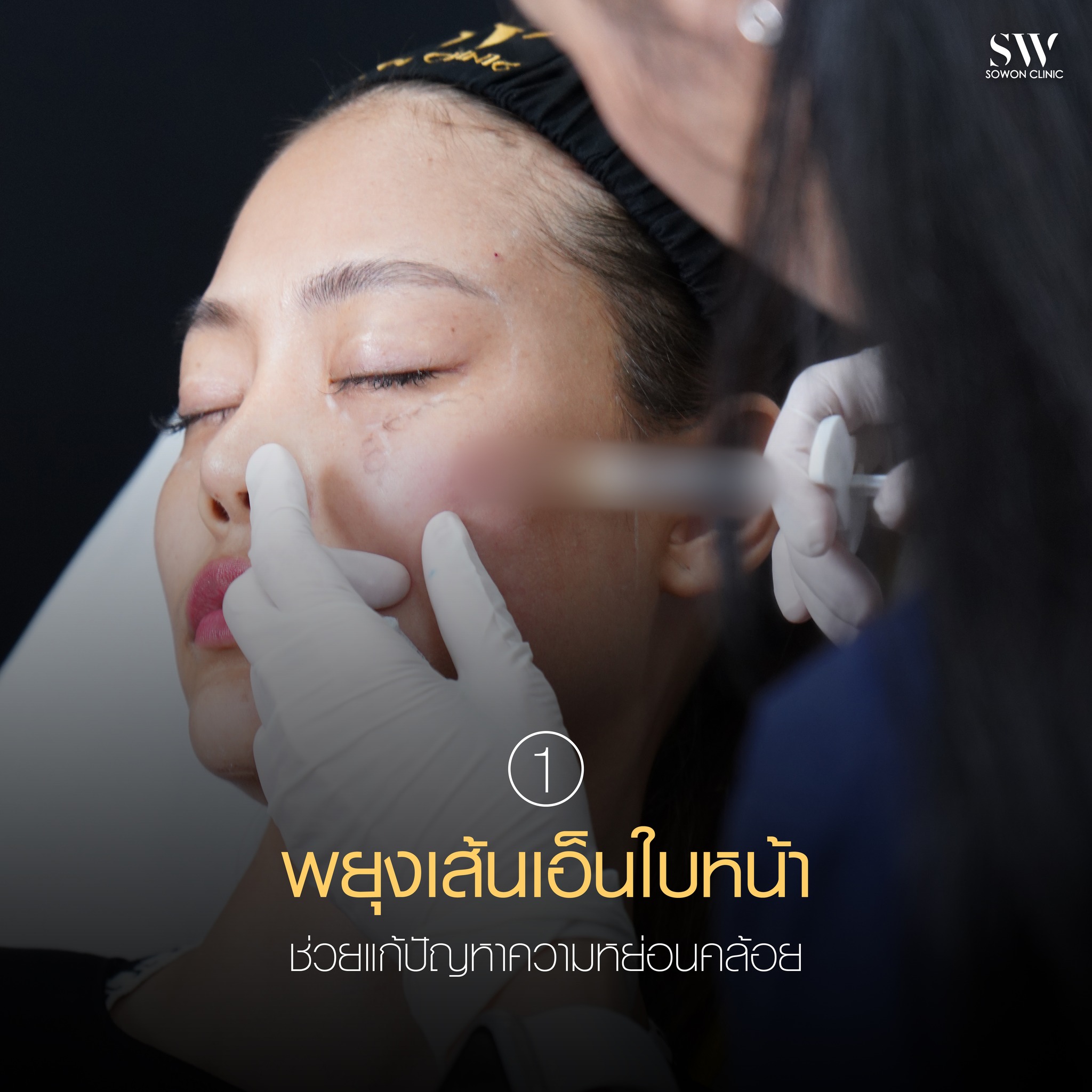 หมอปลอม เทคนิคที่ 1 การพยุงเส้นเอ็น