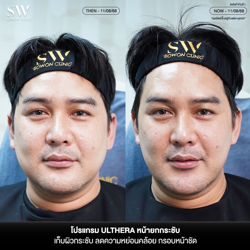 เผยหน้ายก กรอบหน้าชัด 02