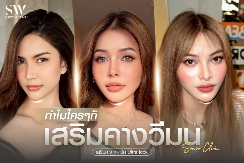 เสริมคาง 01