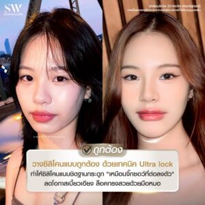 เสริมคาง 03