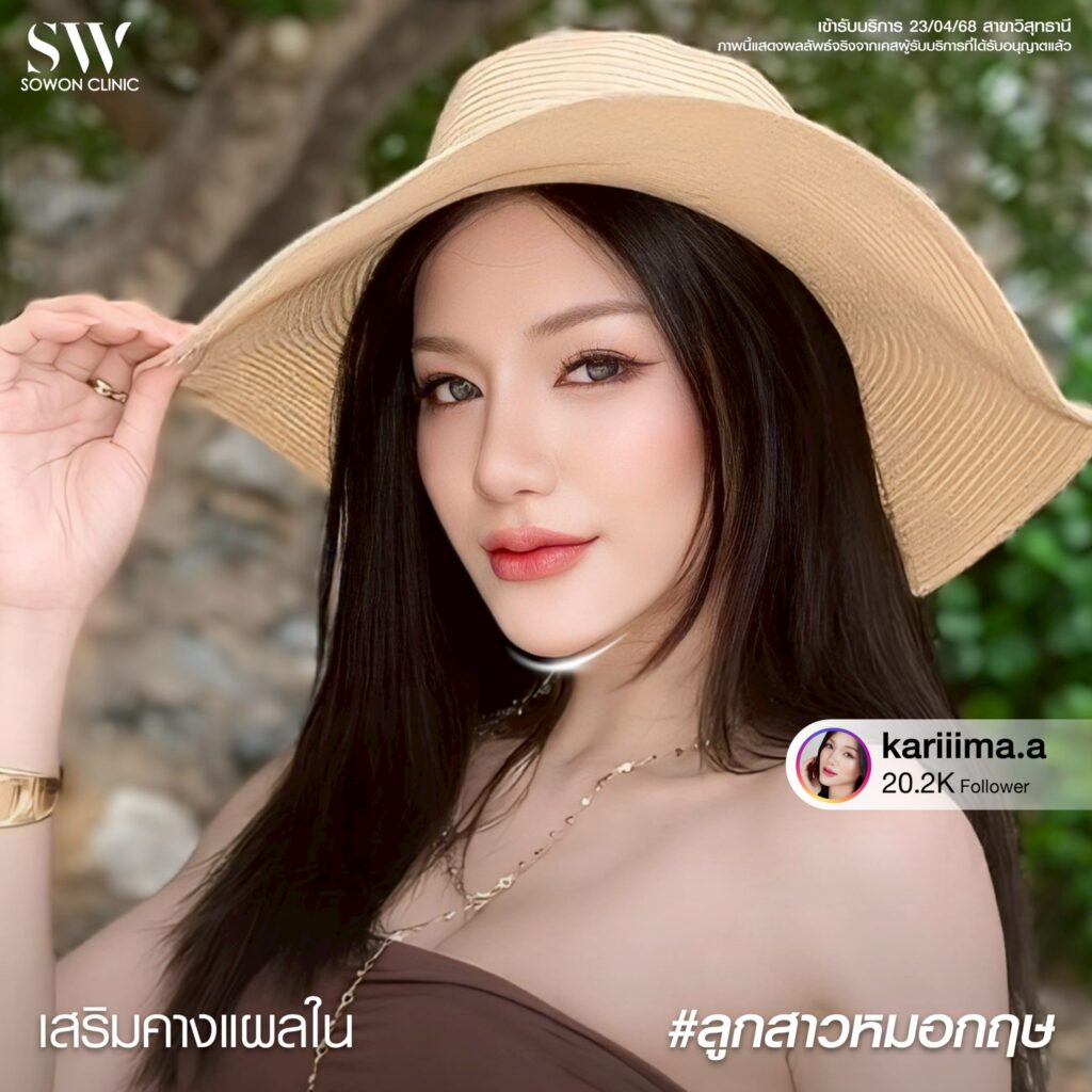เสริมคางแผลใน 01