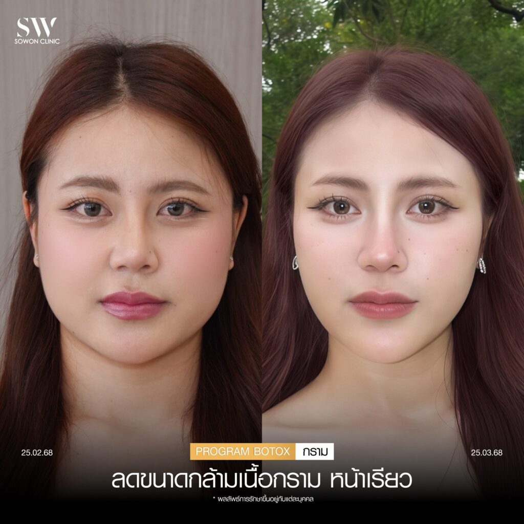 โบกราม หน้าเรียว 04