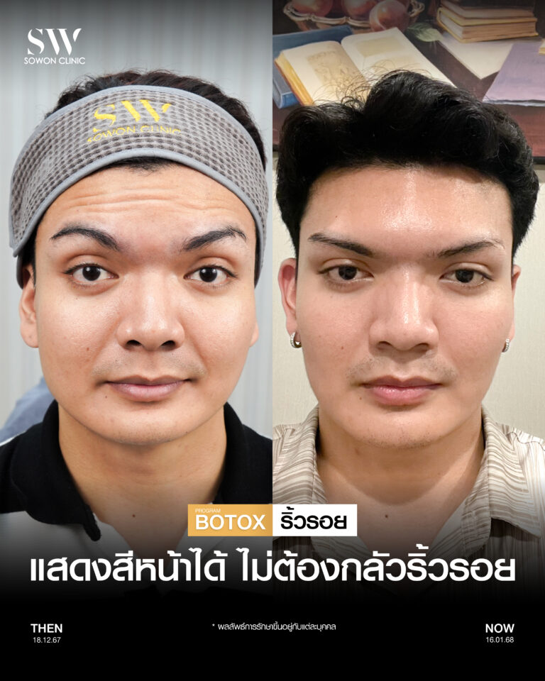 โบริ้วรอย 01
