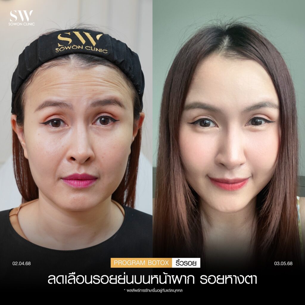 โบริ้วรอย 02