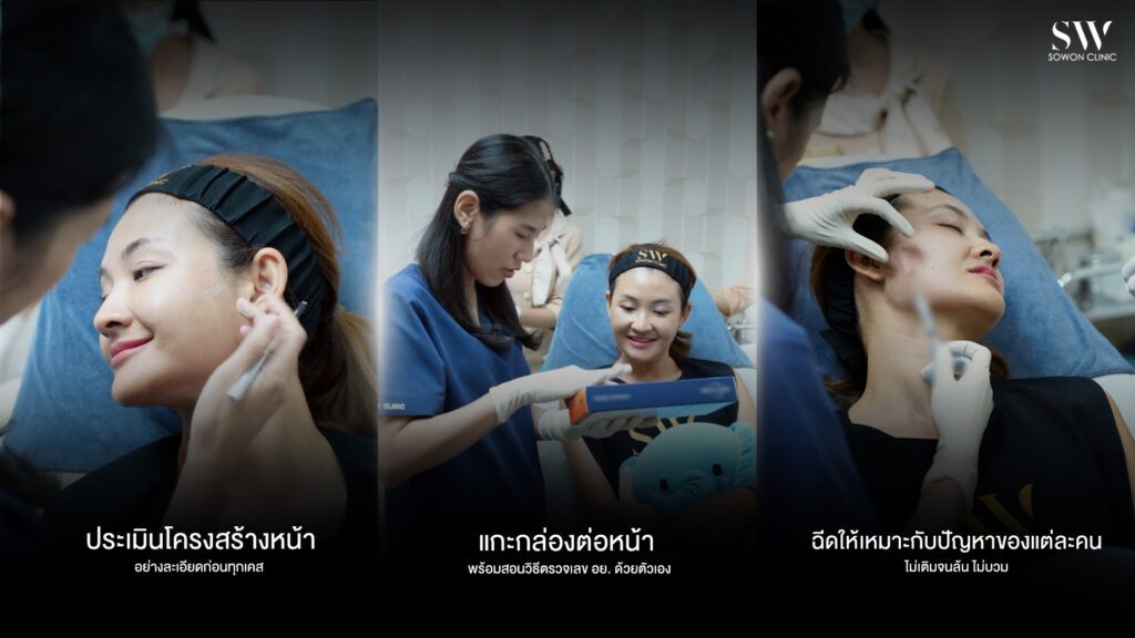 ยกกระชับ เทคนิคของ SW