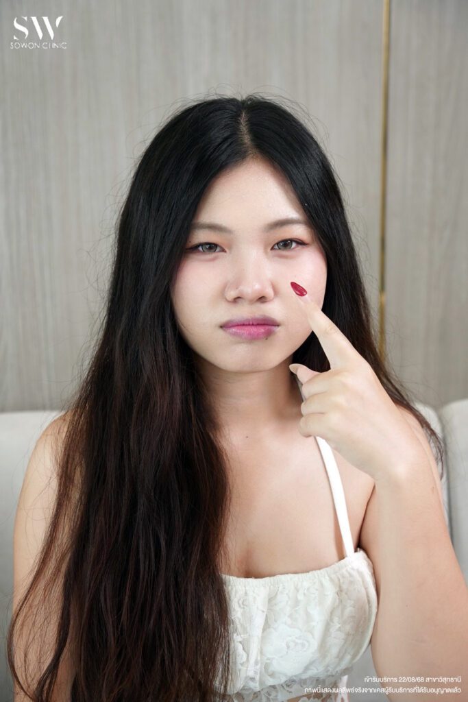ทรงจมูกสโลปปลายพุ่ง ปัญหา