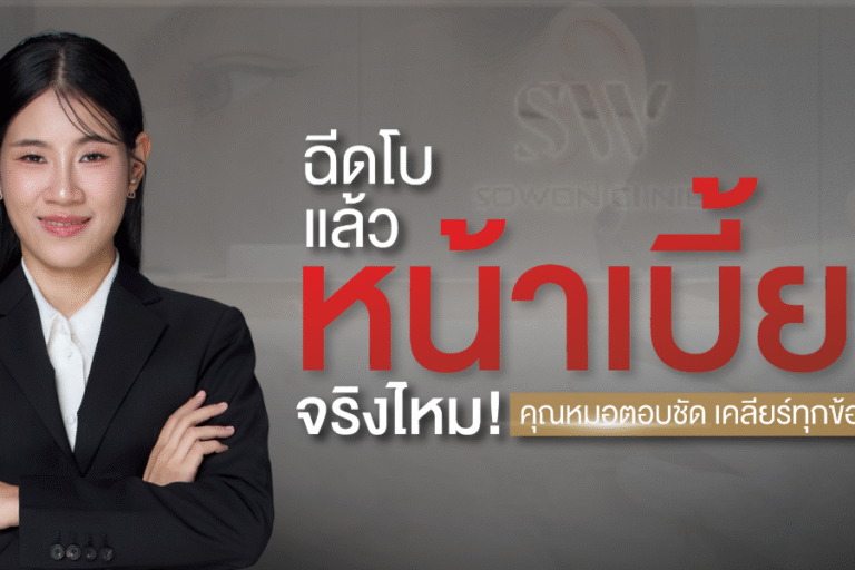 botox-myth-face-asymmetry-skin-botox-knowledge