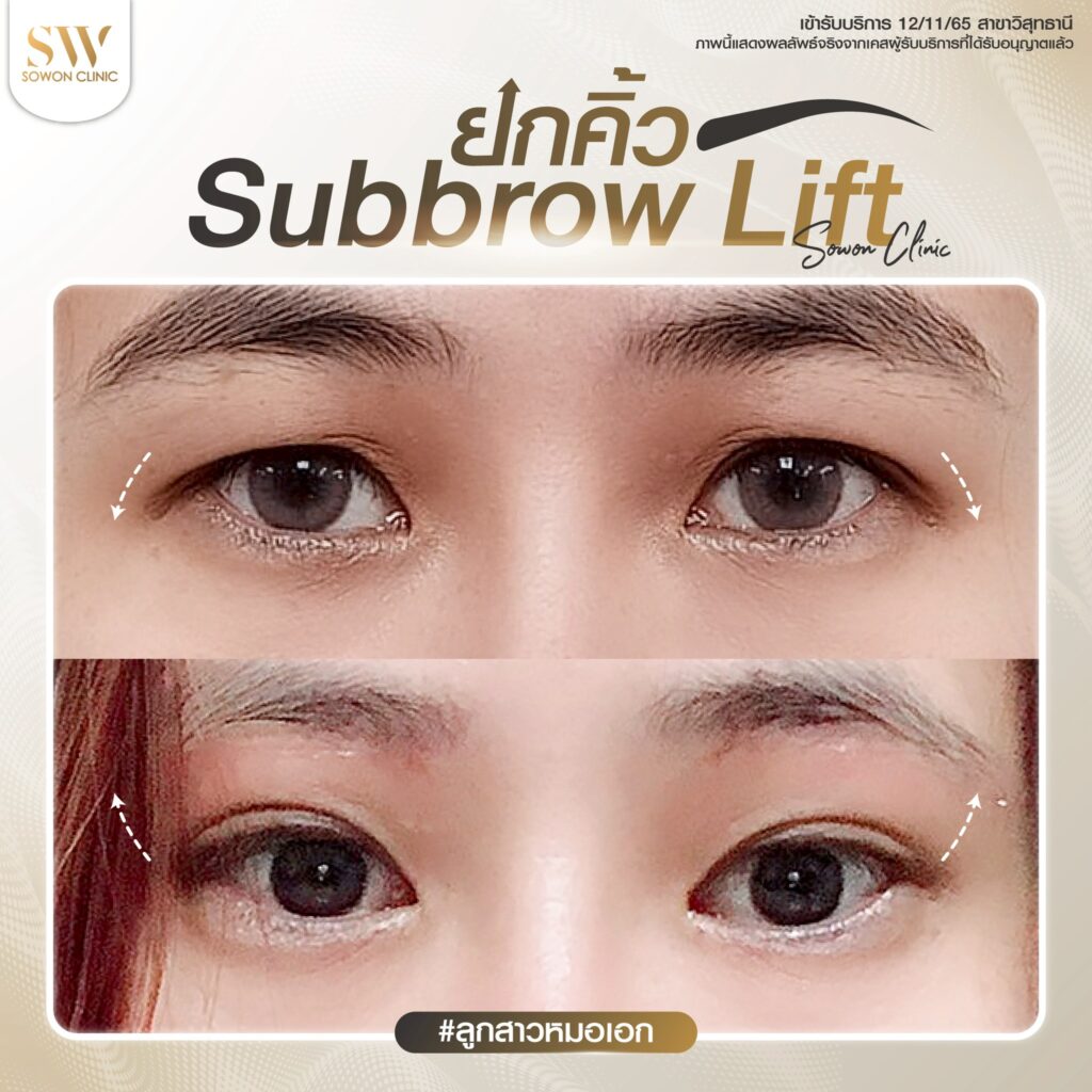 ยกคิ้วรีวิวตา 05