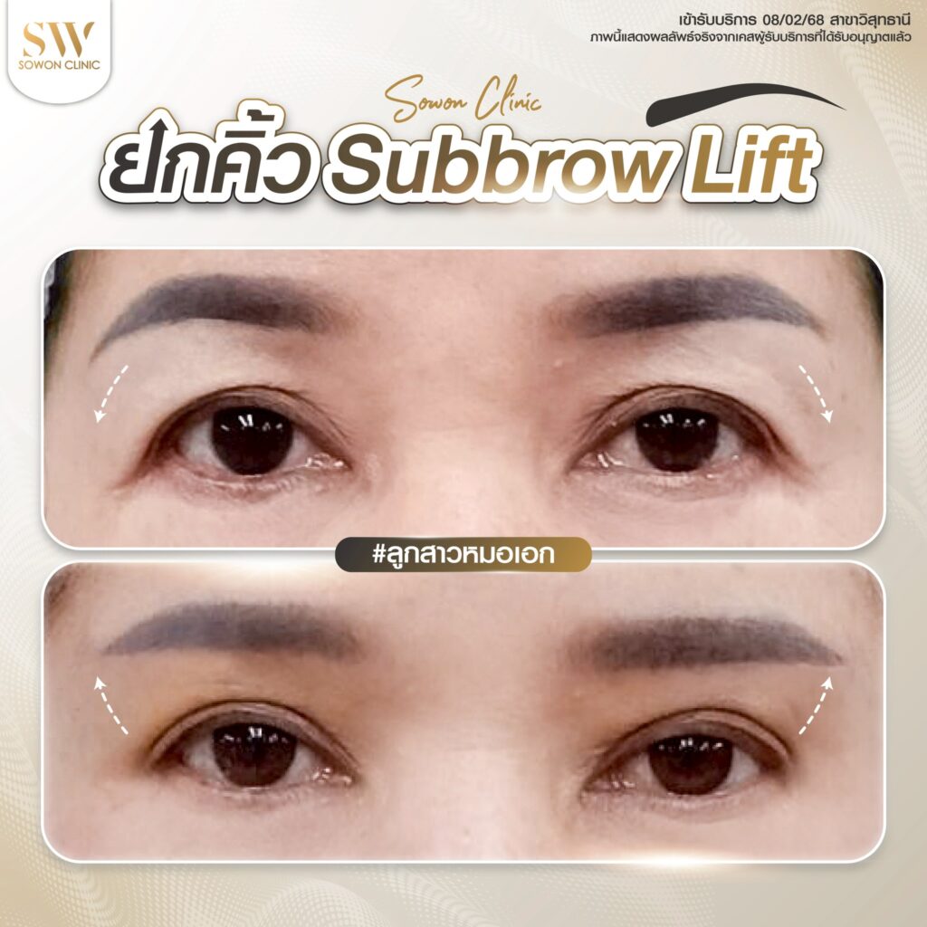 ยกคิ้วรีวิวตา 04