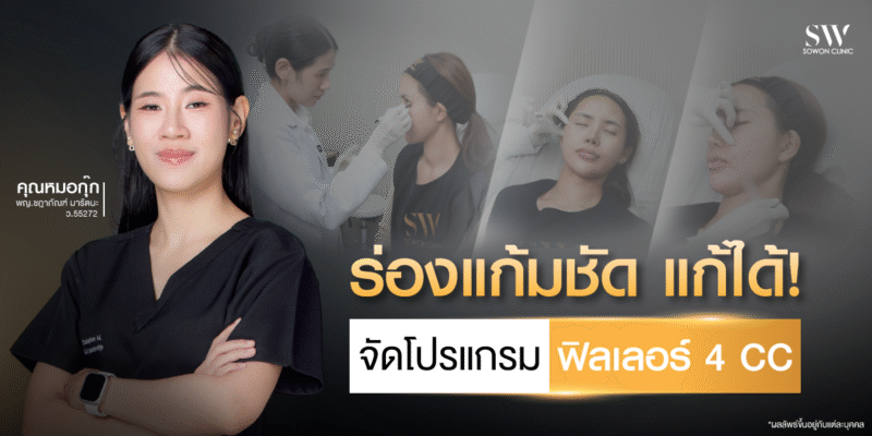 filler-4cc-nasolabial-fold-case-by-dr-kook_skin-filler_review