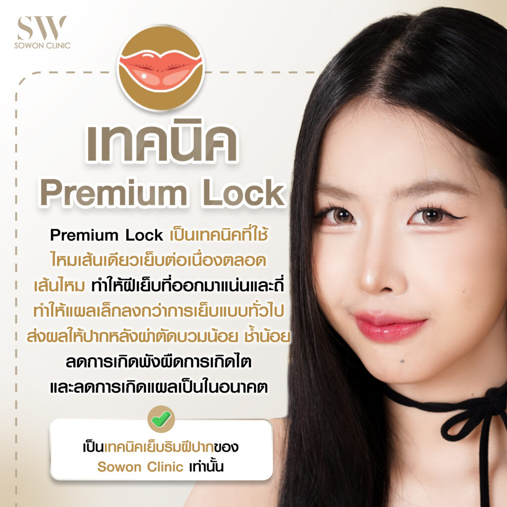โปรโมชั่นปากกระจับ เทคนิค Premium Lock