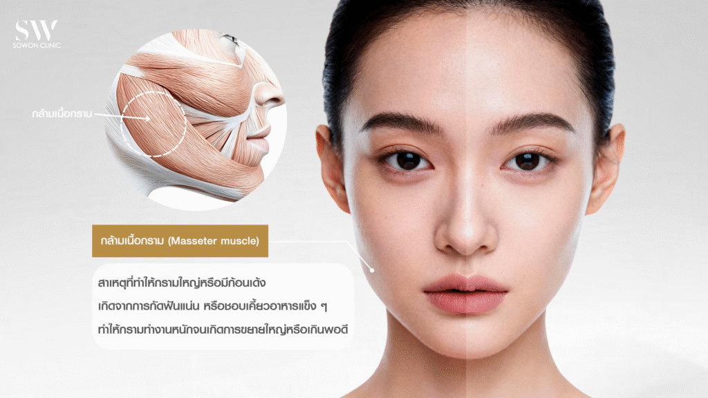 หน้าเรียว_กรามใหญ่ กัดแล้วมีก้อนเด้ง