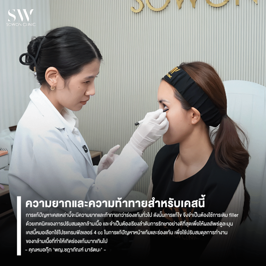 รีวิวฉีดร่องแก้ม ความท้าทายที่หมอต้องเจอ