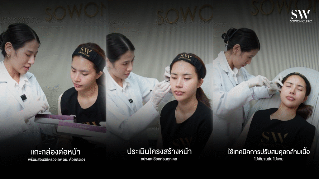 รีวิวฉีดร่องแก้ม เทคนิคเฉพาะ