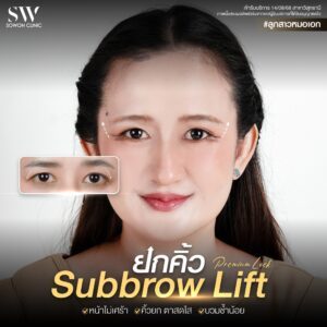 ยกคิ้ว_รีวิว 01