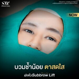 ยกคิ้ว_รีวิว 03