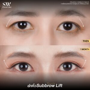 ยกคิ้ว_รีวิว 04