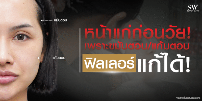 sunken-cheeks-temple-hollows-filler_skin-filler_knowledge