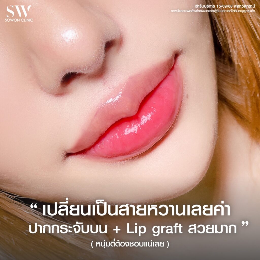 รีวิวปากกระจับ_ปัญหาปาก03