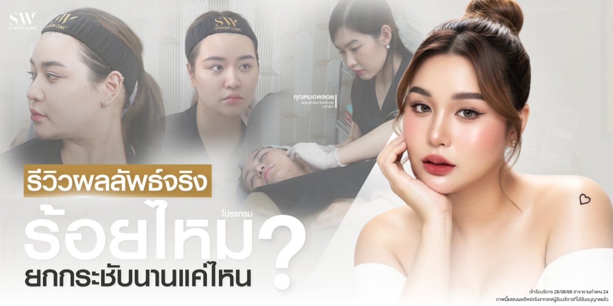 thread-lift-review-how-long_skin_thread_review