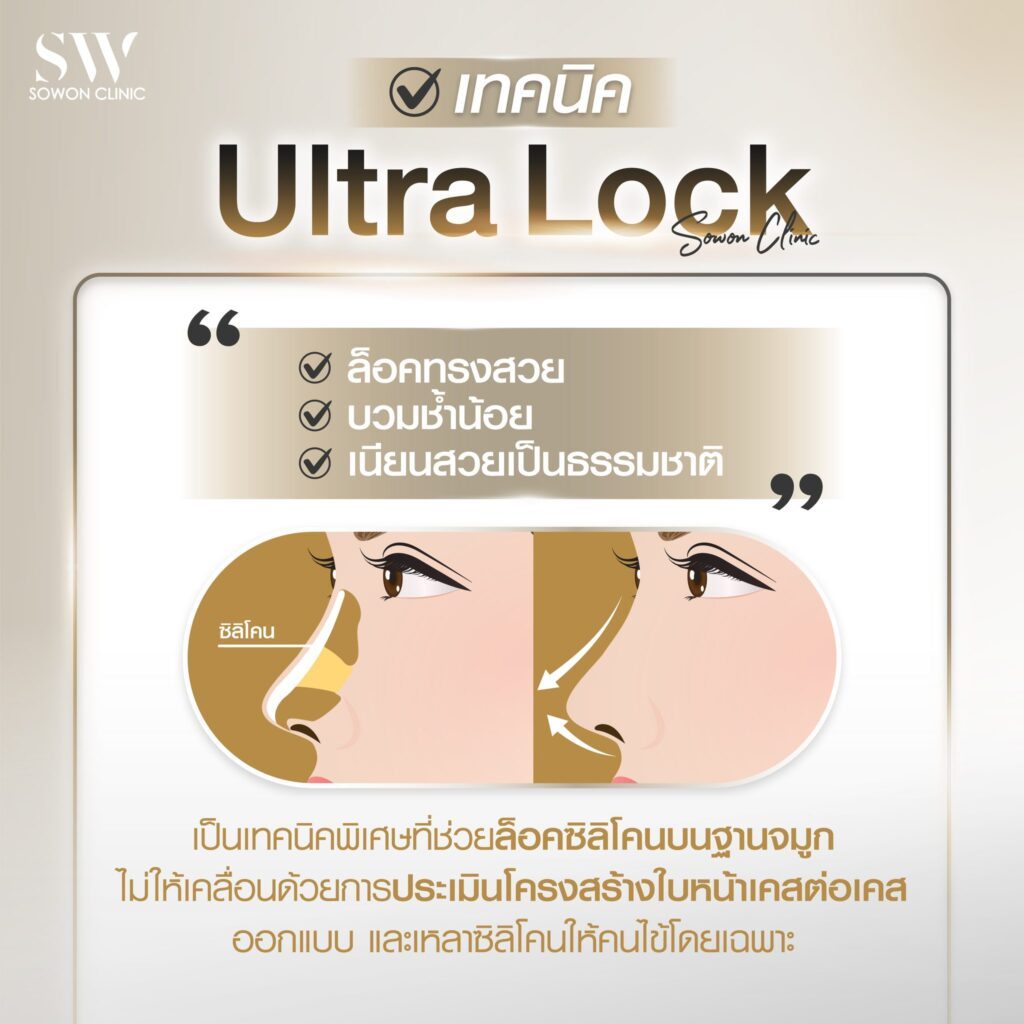 ทรงจมูกสโลปปลายพุ่ง Ultra Lock
