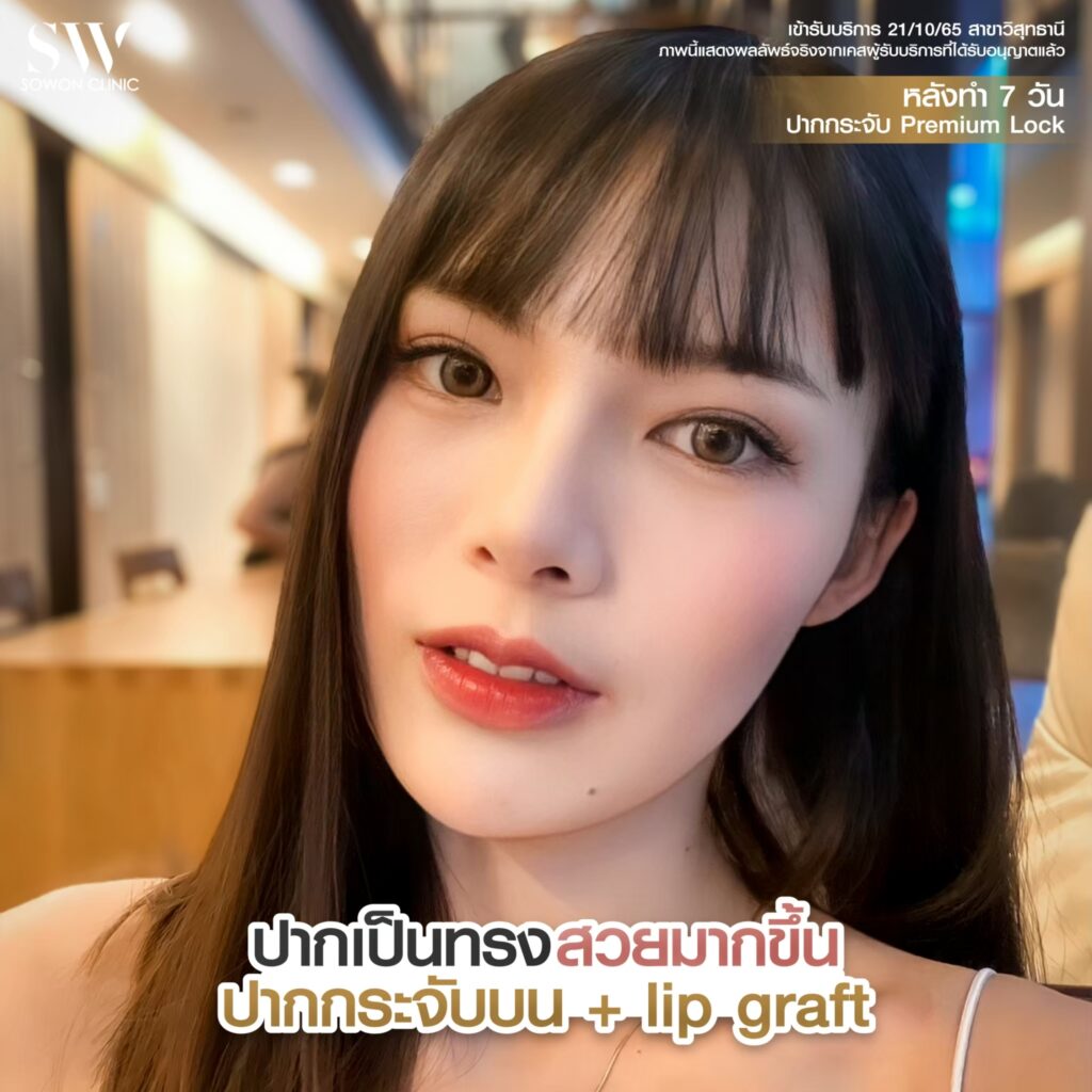 ปากกระจับ10
