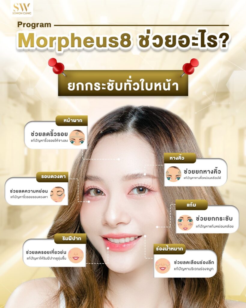ยกกระชับหน้า_โปรแกรม Morpheus8 ช่วยเรื่องอะไร?
