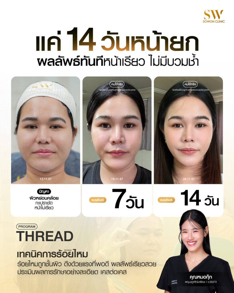ร้อยไหมมิ้นท์04