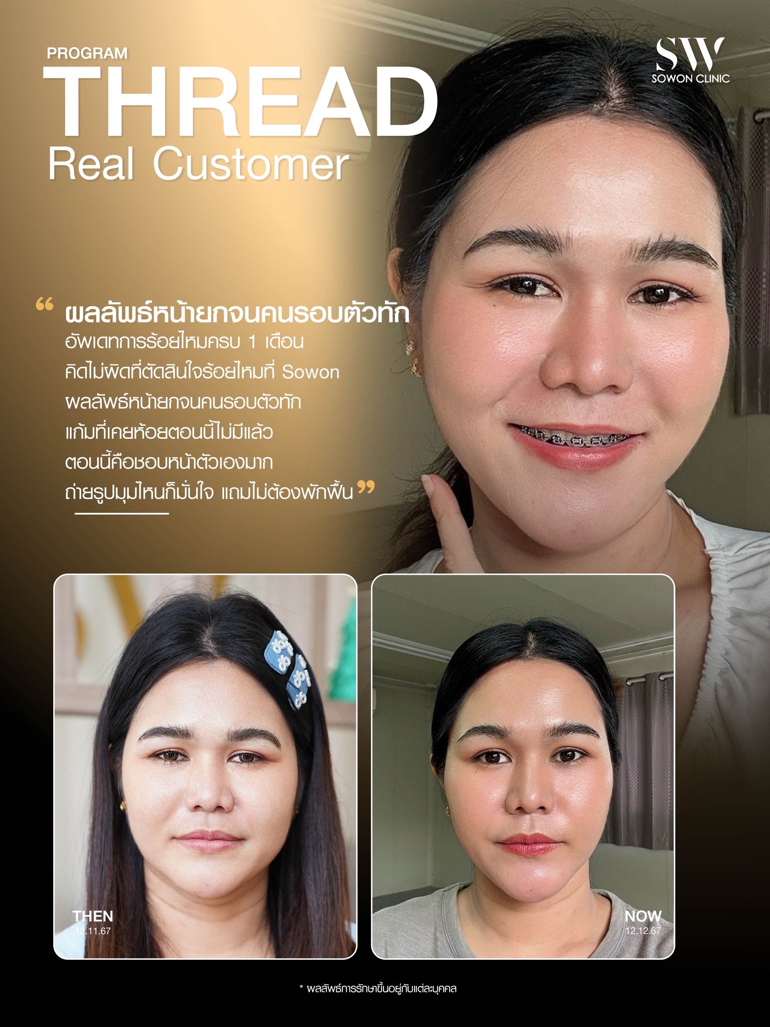 ร้อยไหมมิ้นท์05