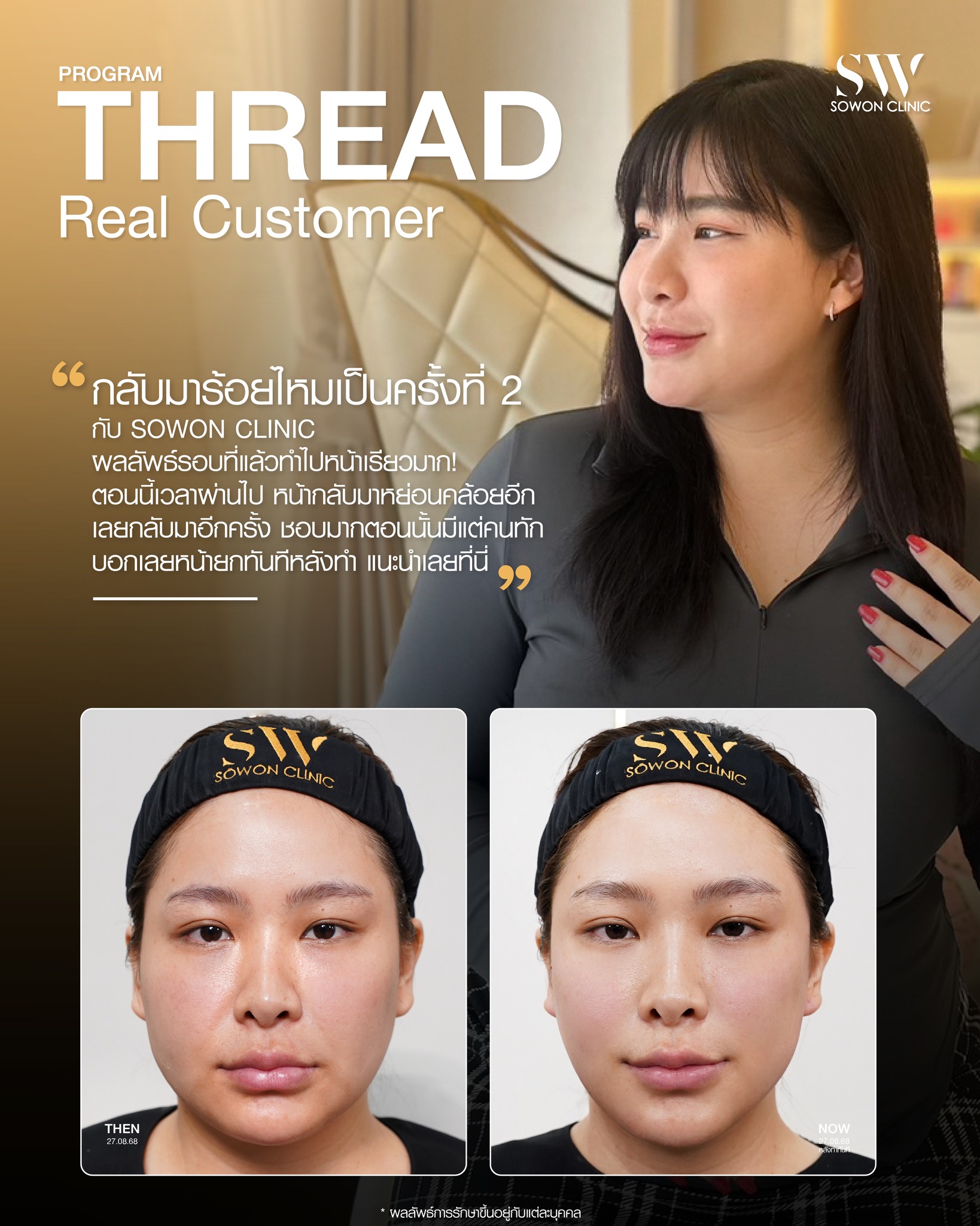 ร้อยไหมมิ้นท์07