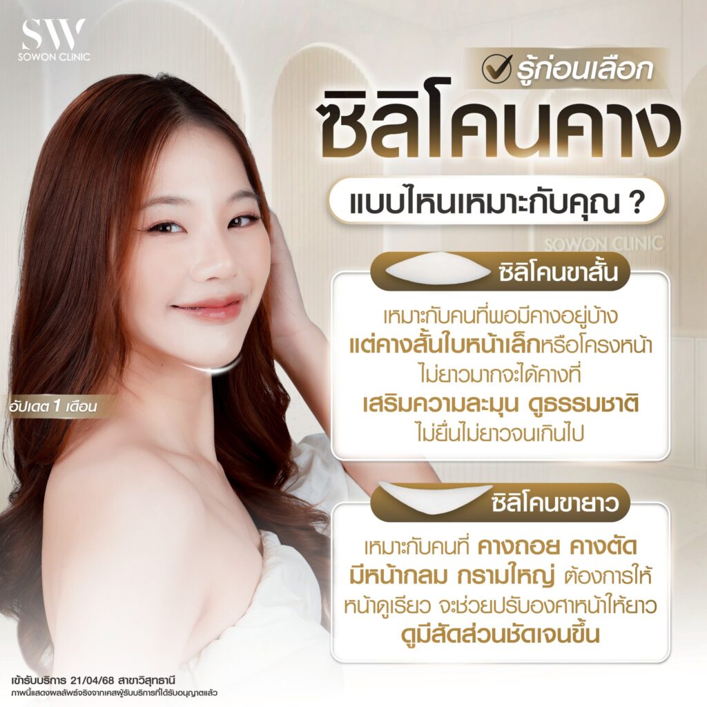 เสริมคาง 15