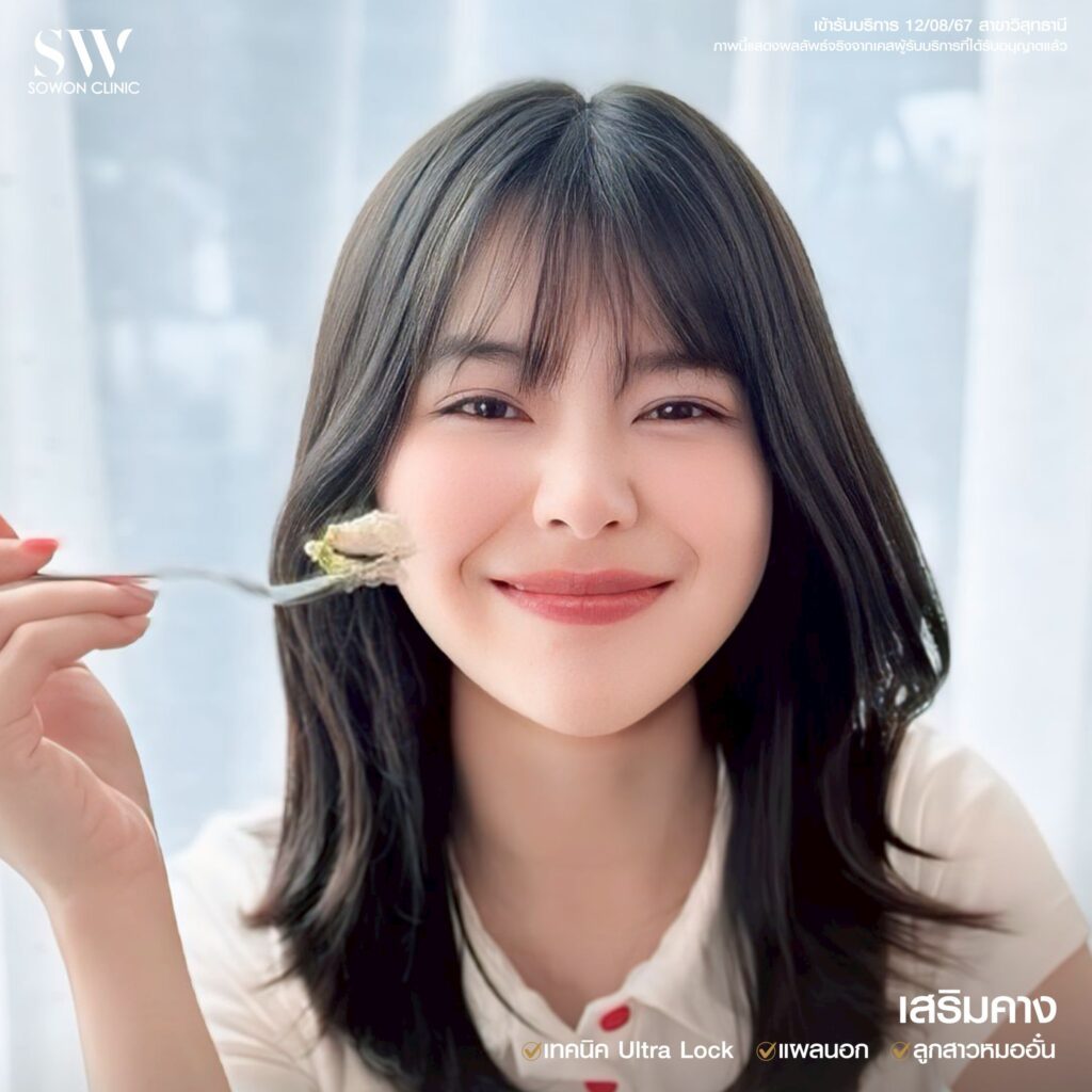 เสริมคาง 18