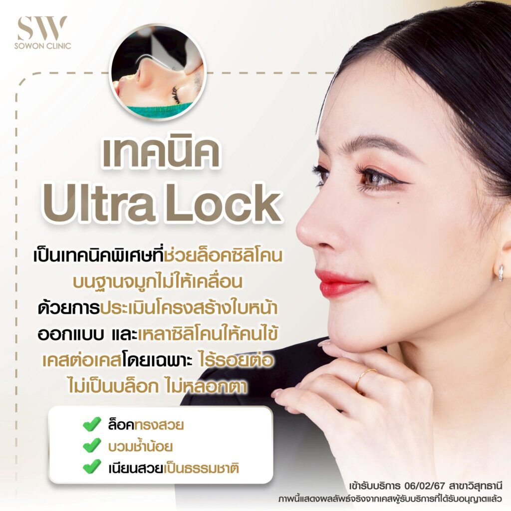 เสริมจมูก 012