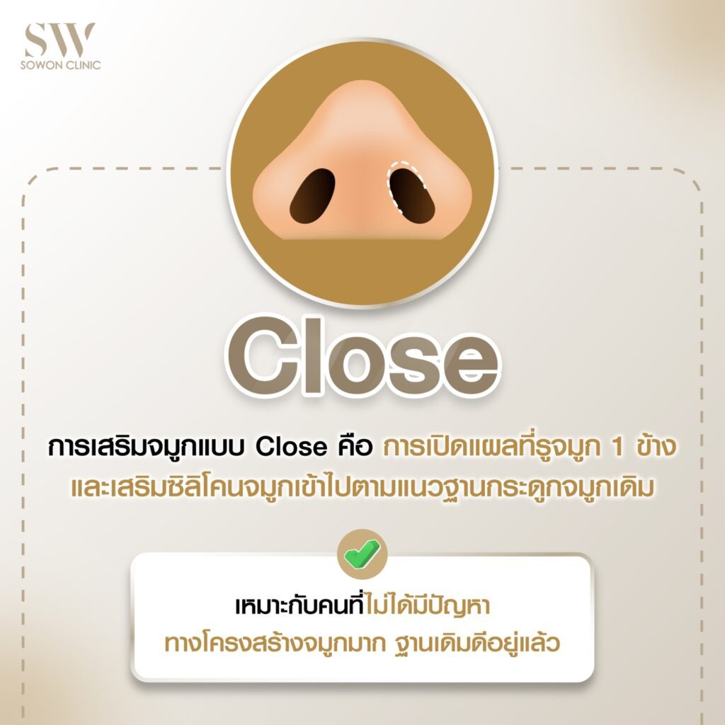 เสริมจมูก 4
